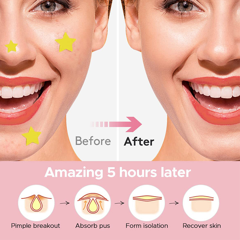 600Pcs/set Star Pimple Patch A - Beauty Makeup Tools recension och pris
